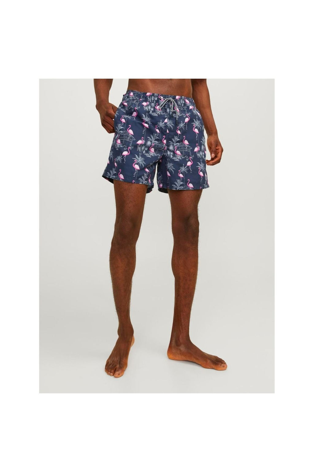 Jack&Jones Flamingo Desenli Erkek Plaj Şortu - Yazın Stilini Yakala!